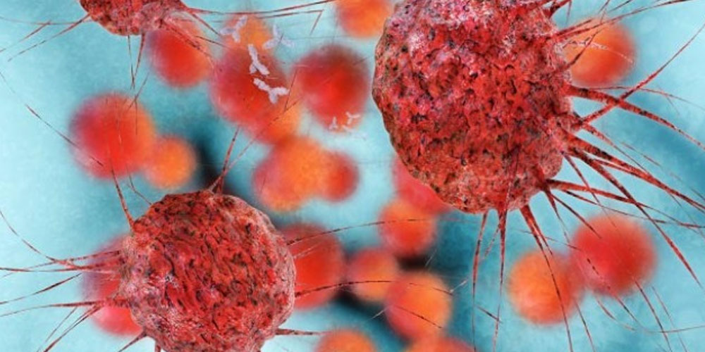 Virus de la grippe qui attaque le cancer de la vessie